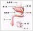 前列腺炎